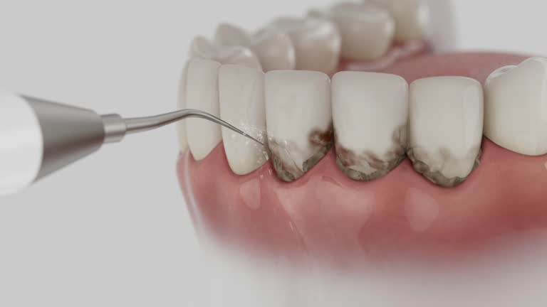 Trusted Dental Crowns And Bridges service in Selinsgrove, PA - Dentist Open Now